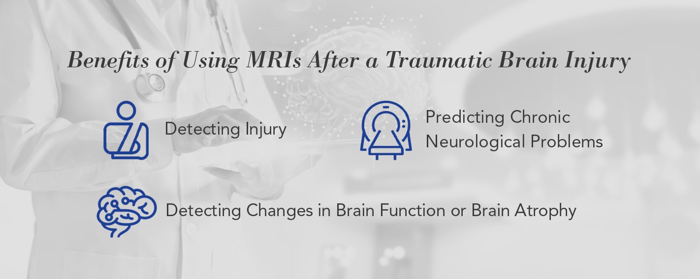 Benefits of Using MRIs After a Traumatic Brain Injury