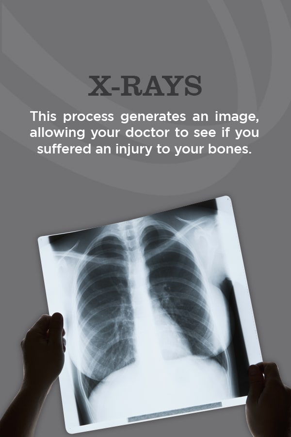 X-Rays