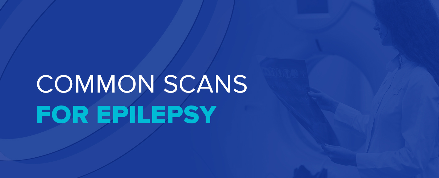Common Scans for Epilepsy