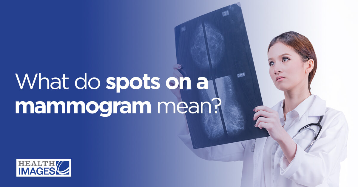 What Do Spots on a Mammogram Mean?