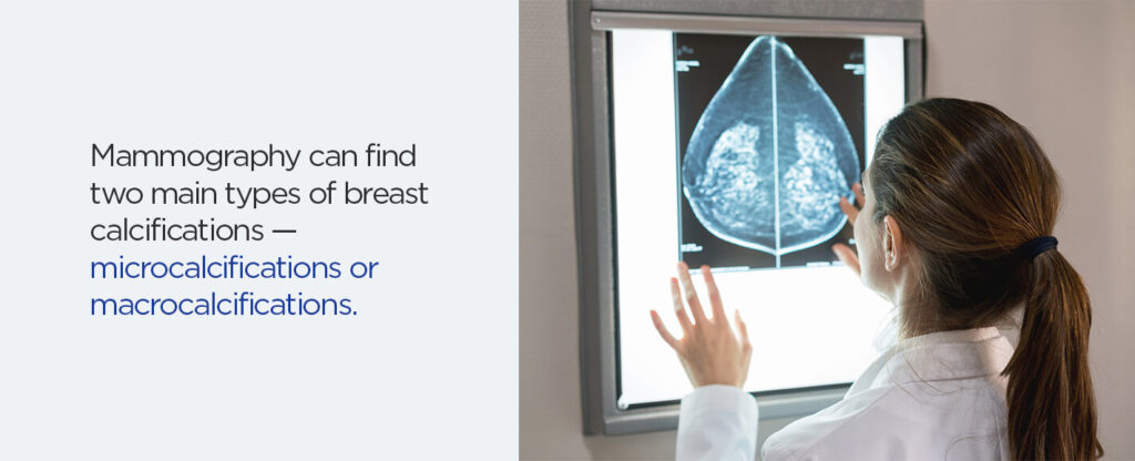 What Do Spots On A Mammogram Mean Health Images