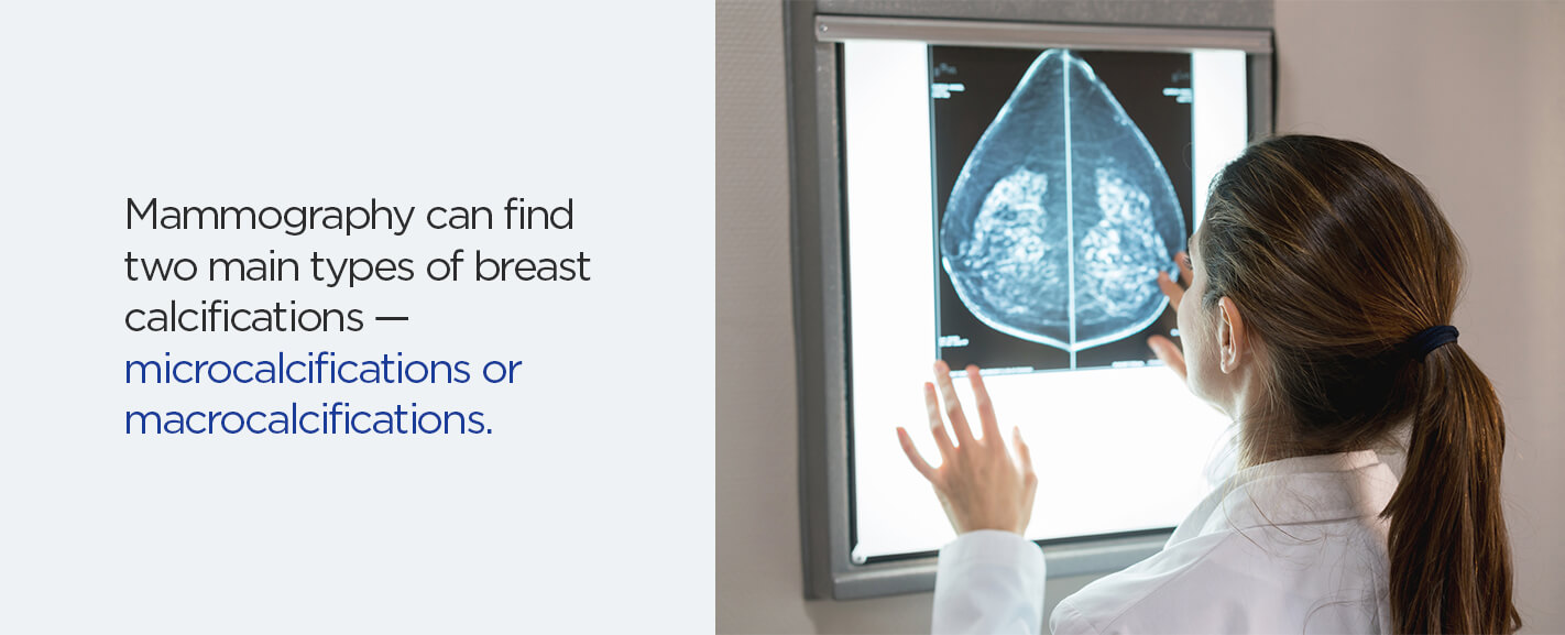 Types of Calcifications