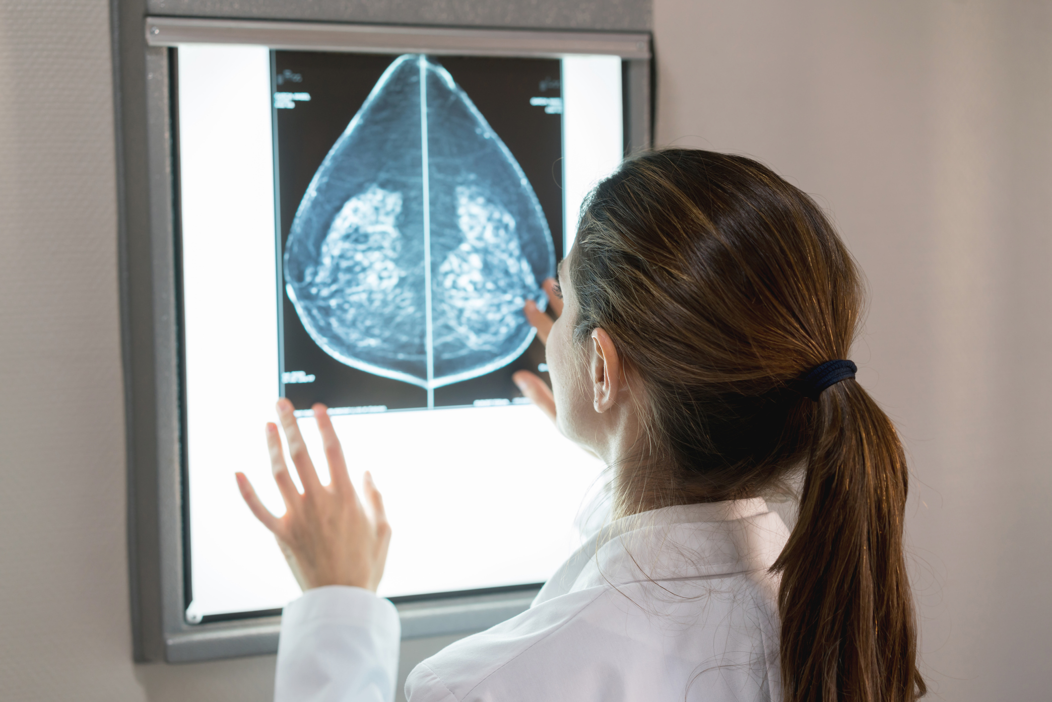 what do spots on a mammogram mean