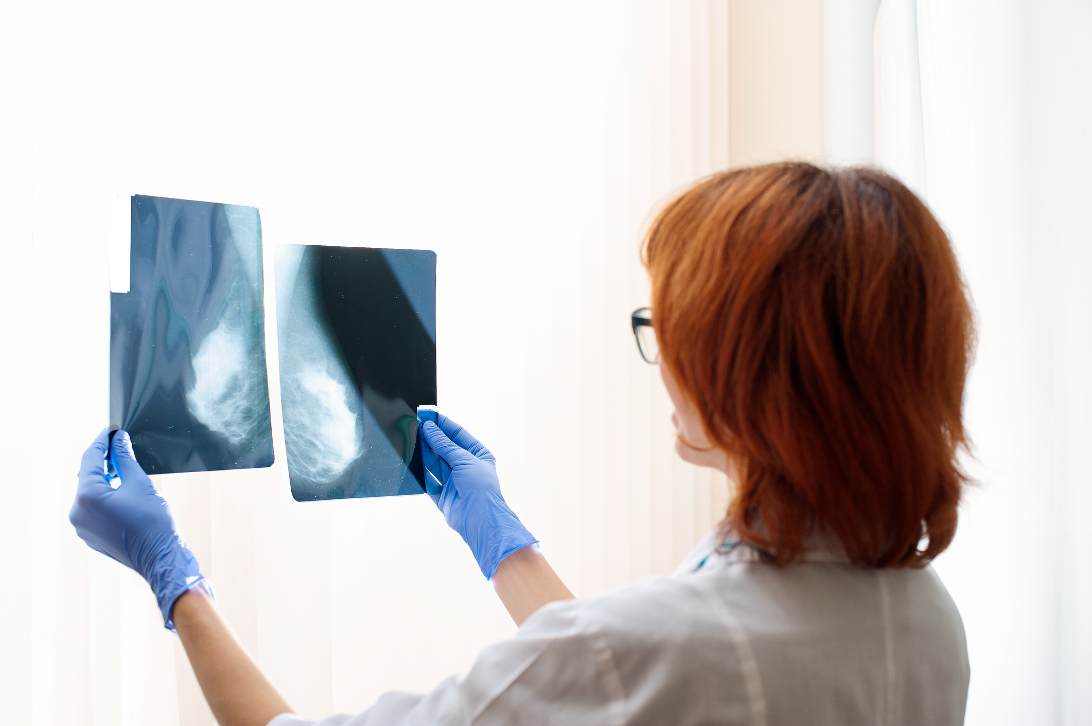 how to read a mammogram report