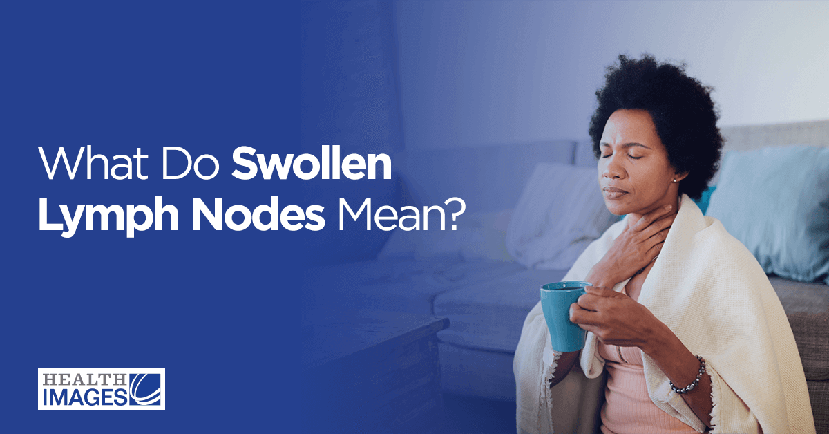 Swollen lymph nodes