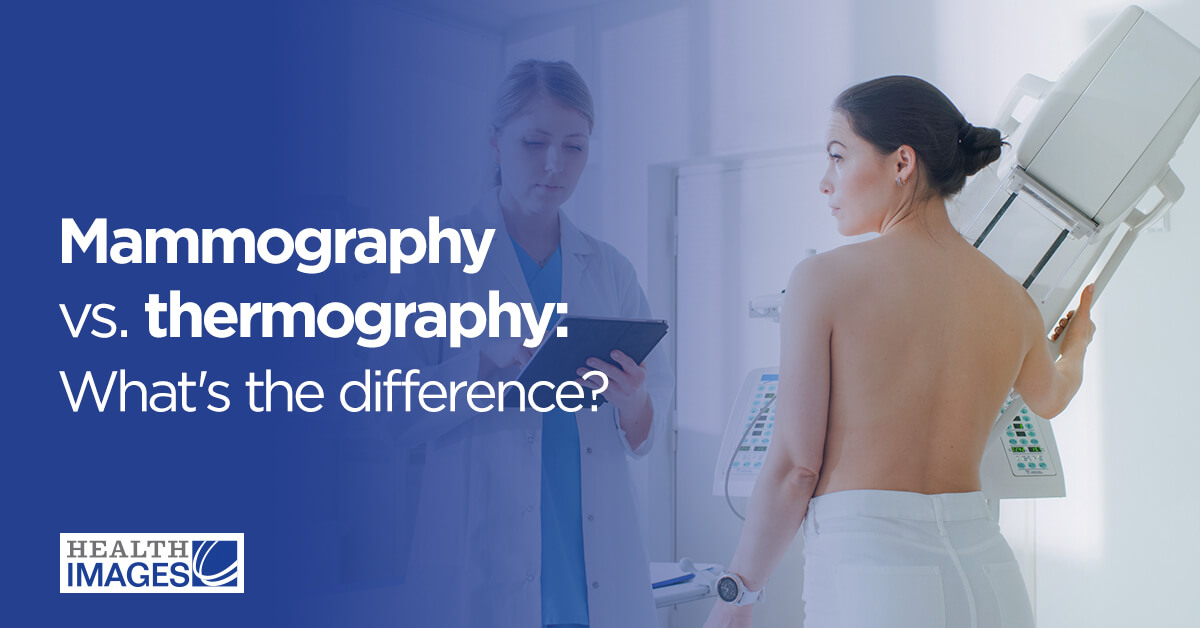 mammography vs thermography