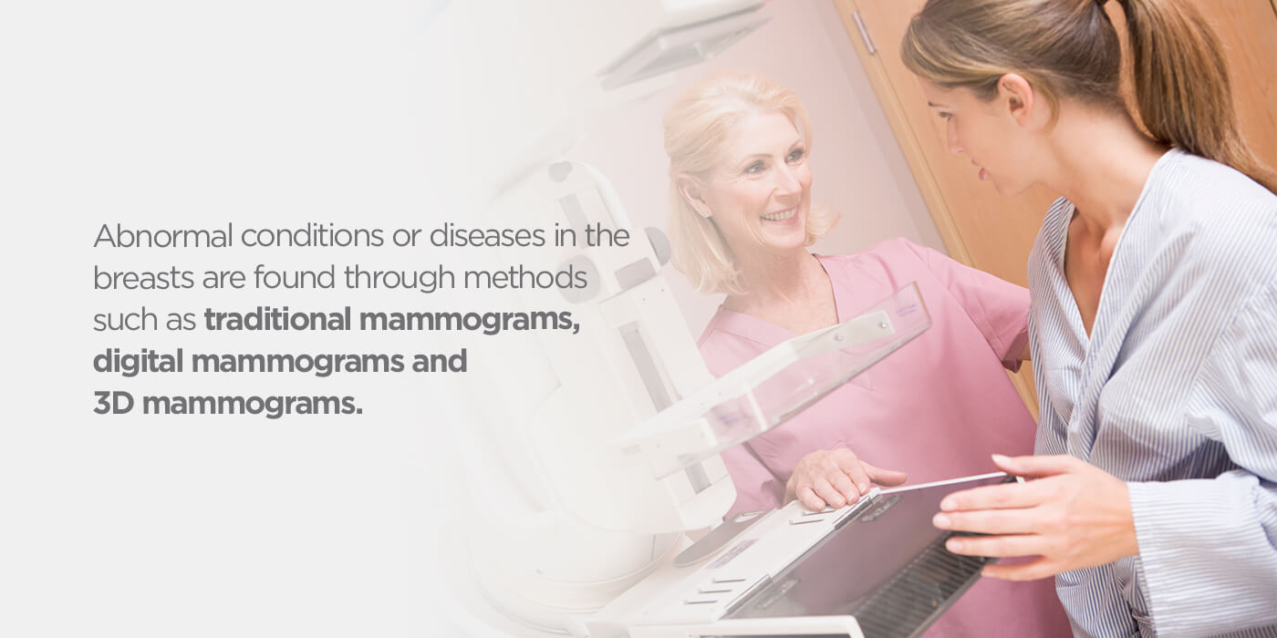 What-is-mammography