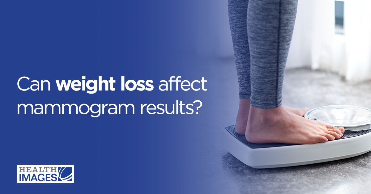 Can Weight Loss Affect Mammogram Results?