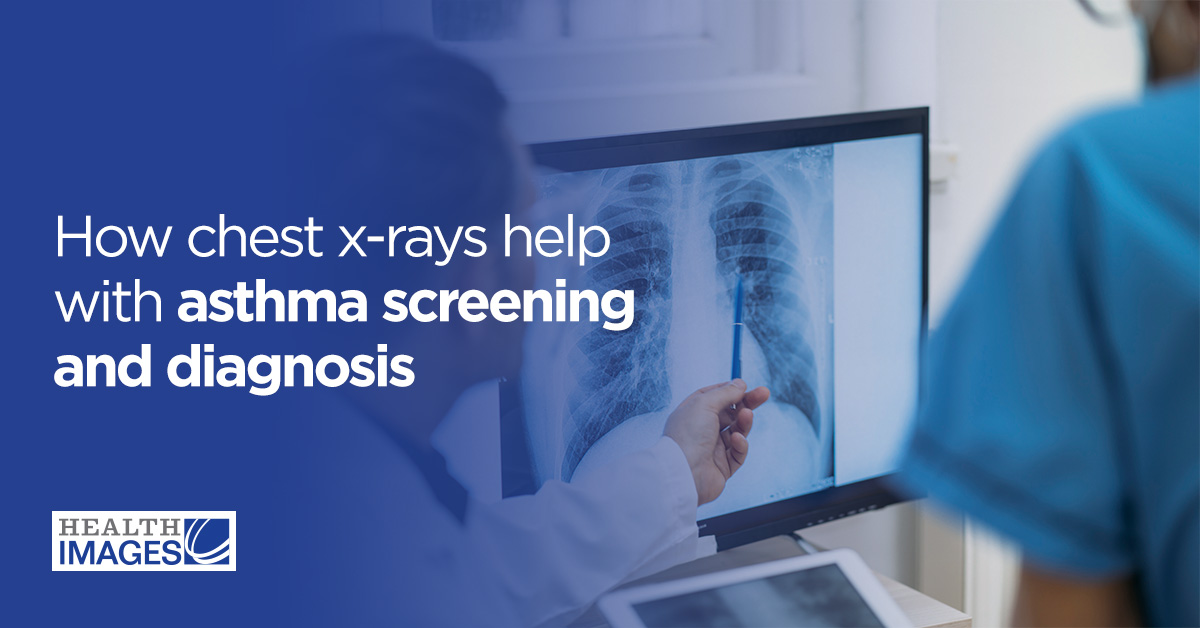 chest x-rays