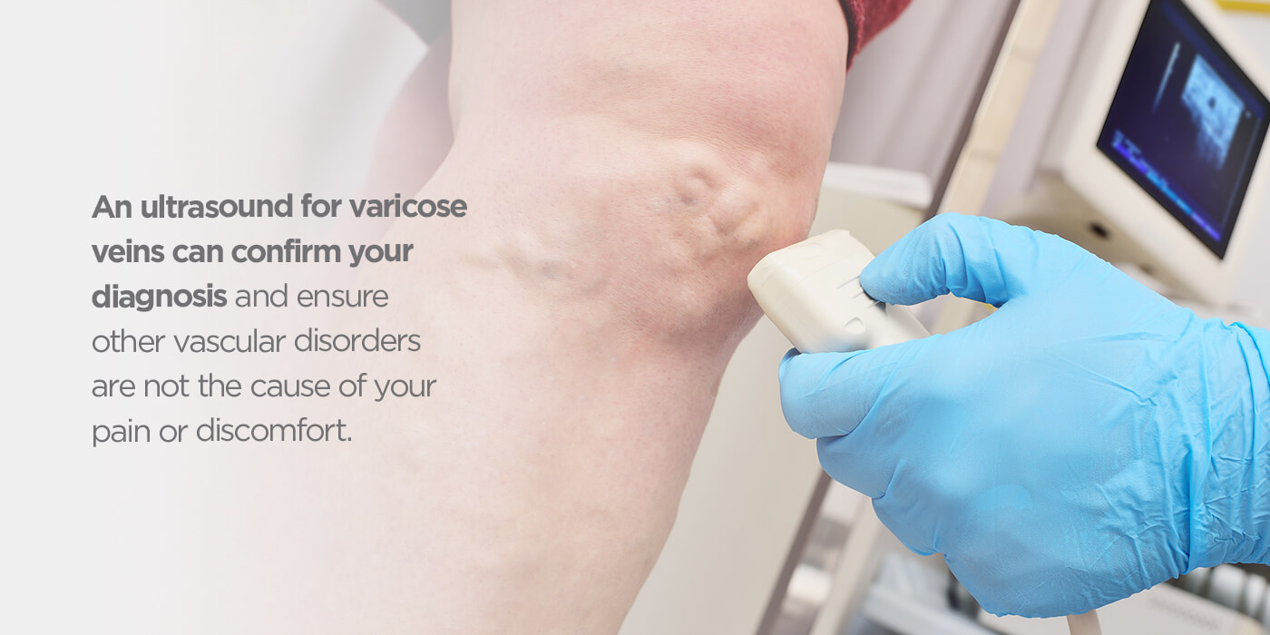 Can an ultrasound detect varicose veins?