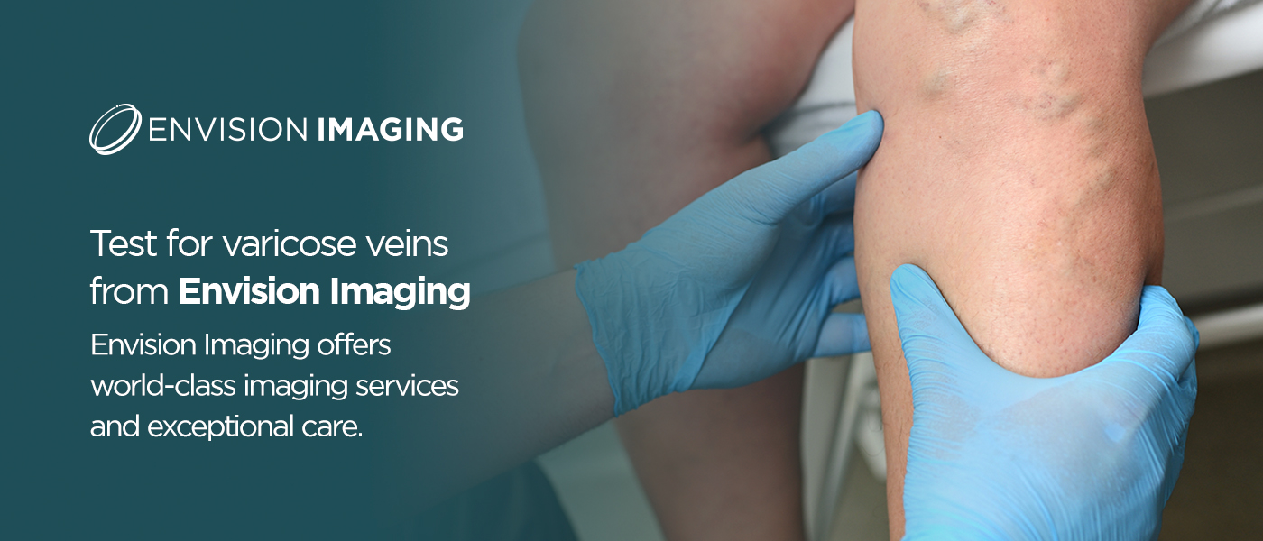 Test for varicose veins from Envision Radiology