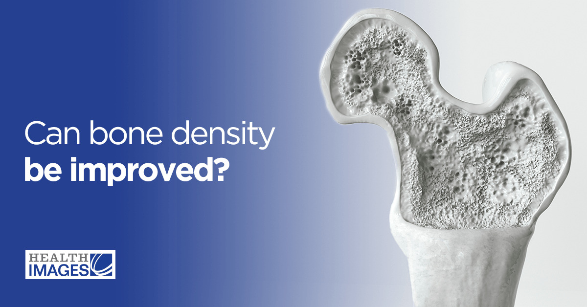 Can Bone Density Be Improved?