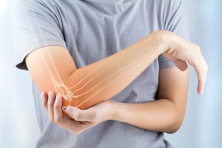 Bone Health and Osteoporosis: What You Need to Know About Strong Bones